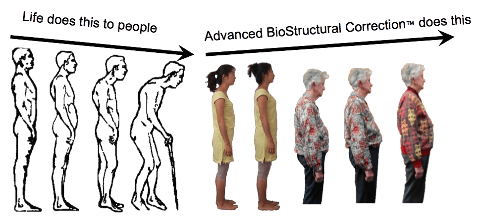 Graphic showing regression in posture as a man ages on the left side and people showing improved posture after ABC treatments on the right side.