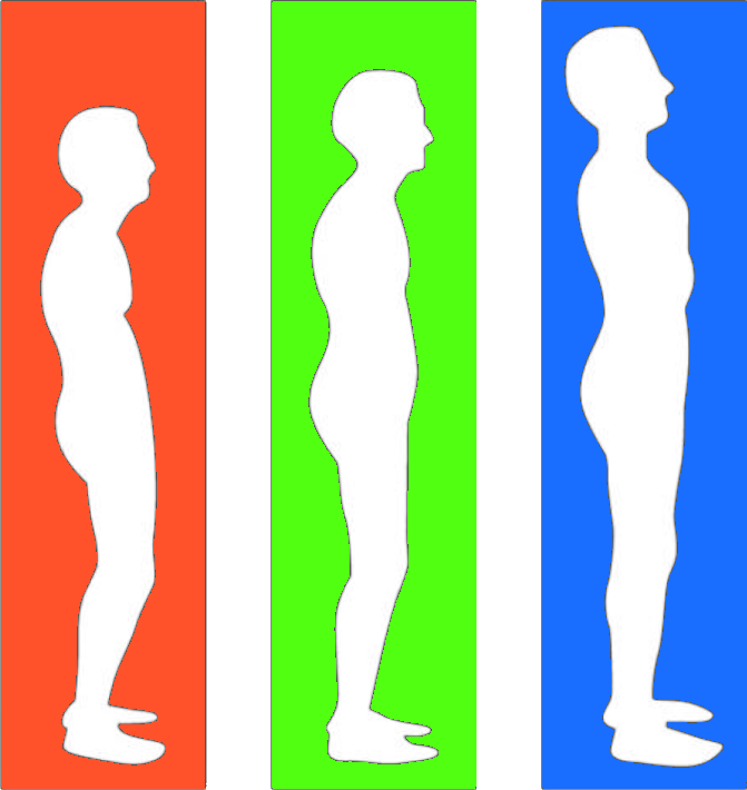 Graphic showing three silhouettes of man standing with poor posture, slightly improved posture, and finally correct posture to illustrate improvements over several Advanced BioStructural Correction™ treatments.