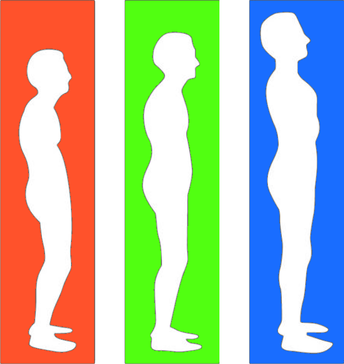 The Posture Cure