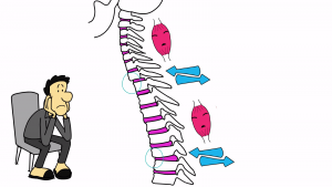 Graphic showing a person sitting with pain and a close-up section of his muscle tissue hurting which Advanced BioStructural Correction as offered at True Healing and Wellness can fix completely,