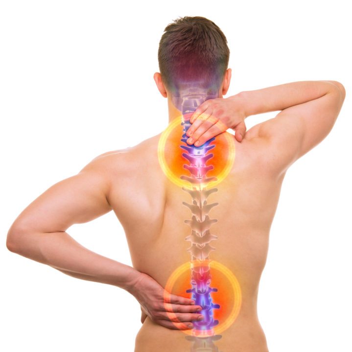 Graphic depicting how compensations from spinal injuries cause pain