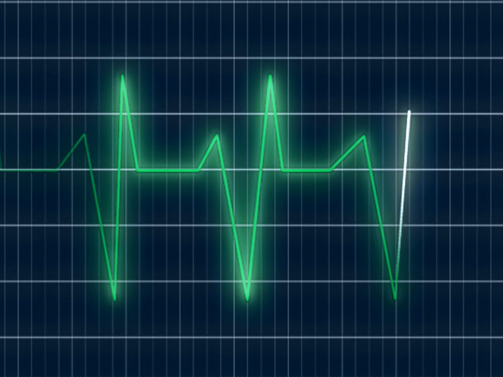 Graphic showing heart rate graph