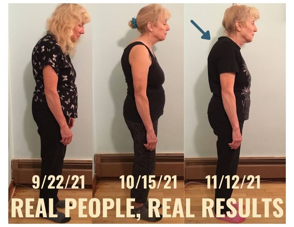 Photo showing significant improvement in posture of a senior female within a 7 week period.